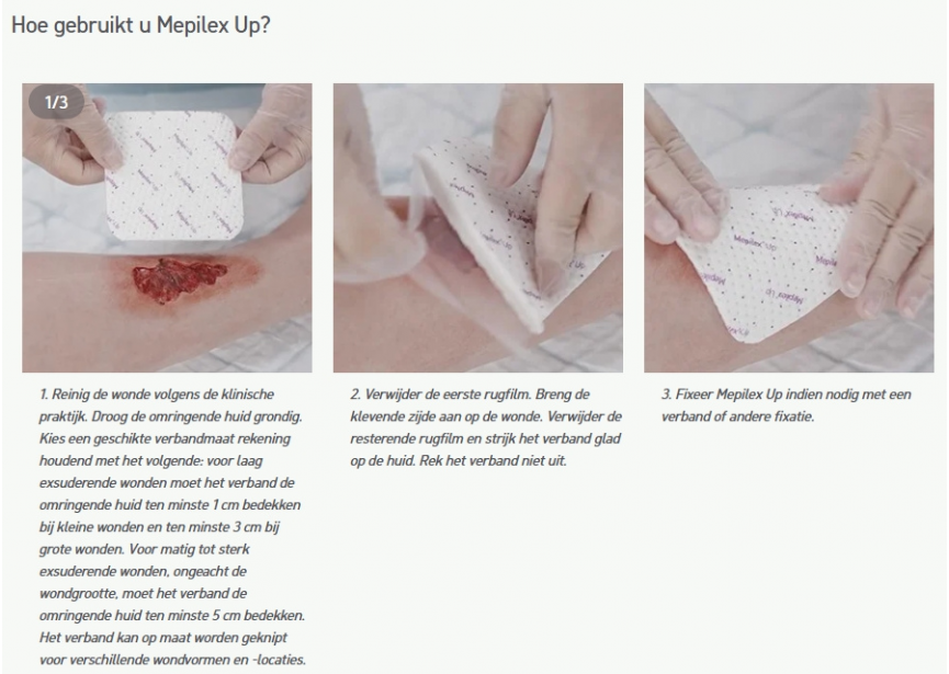 Mepilex-up